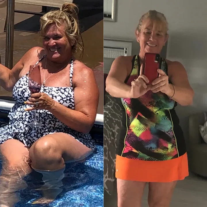 Melinda, before and after.