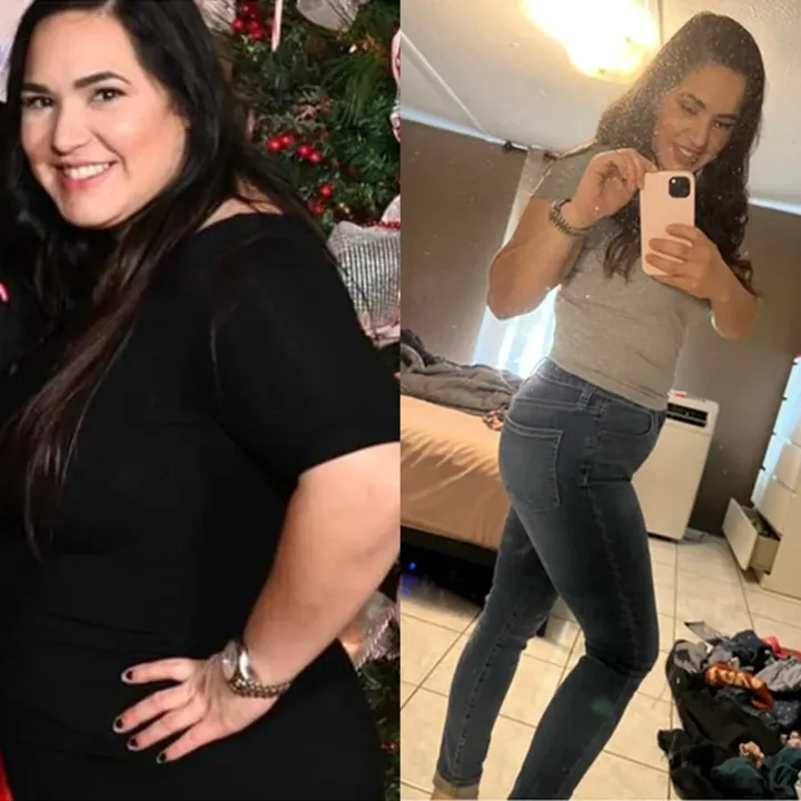 Vanessa, before and after.