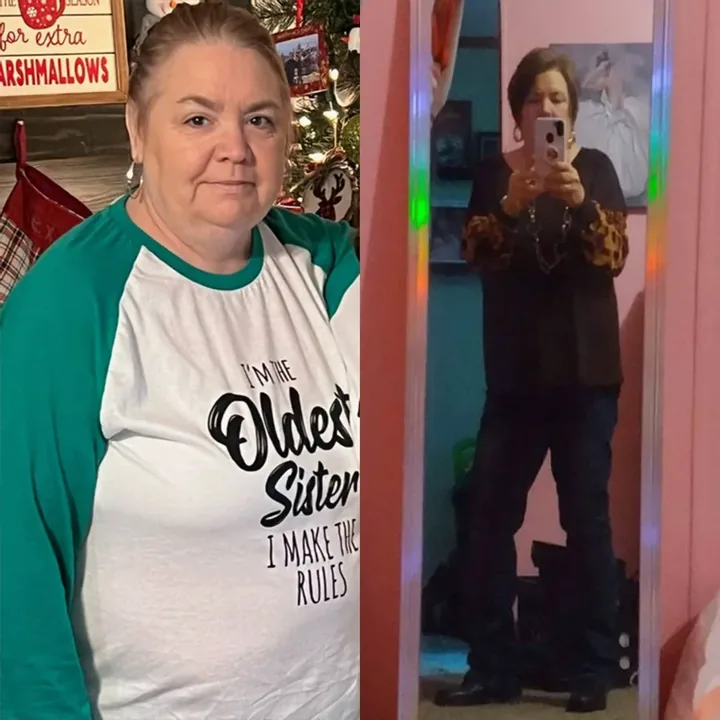 Vicki, before and after.